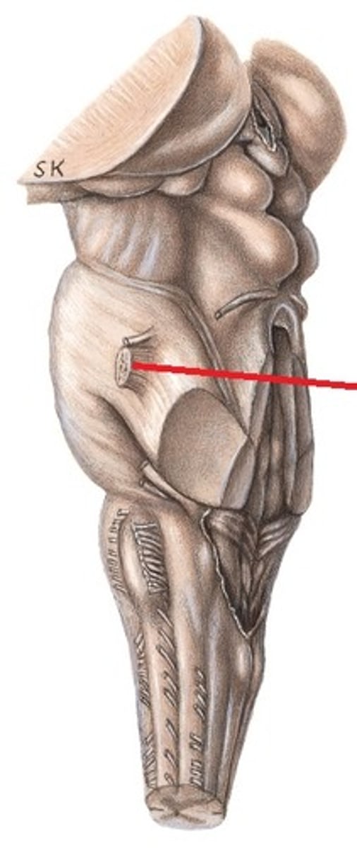 <p>Pons'i ja pedunculus cerebellaris medius'e piiril</p>