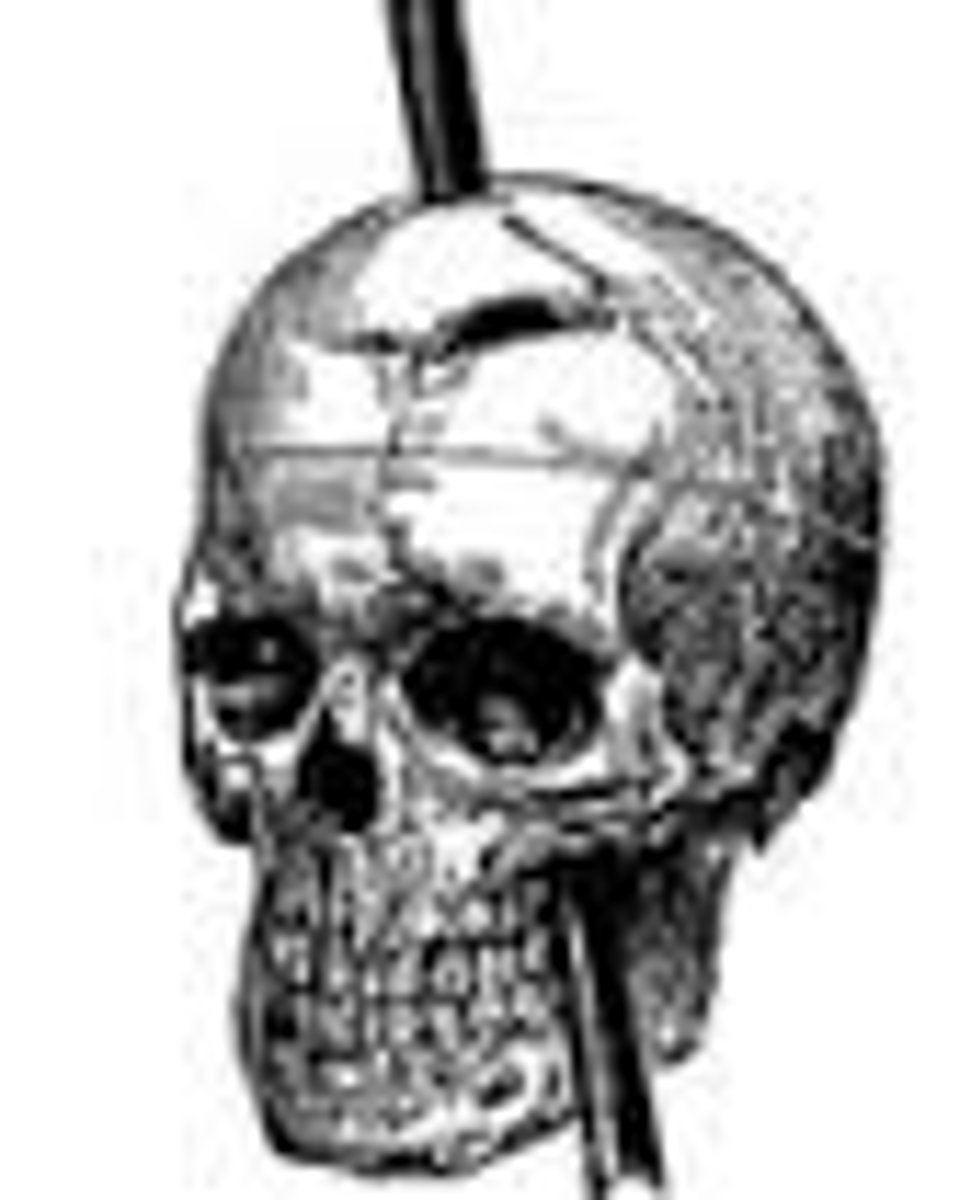 <p>A study of one individual or group that had a bizarre and unusual situation that would be unethical to replicate. Phineas Gage is a famous example. Limited to only description (no causation).</p>