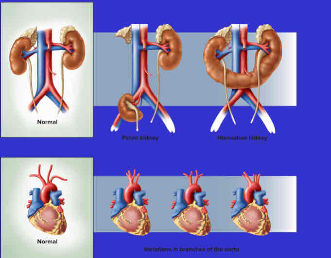<p>The concept that no two humans are exactly alike, with variations such as missing muscles or atypical vertebrae.</p>