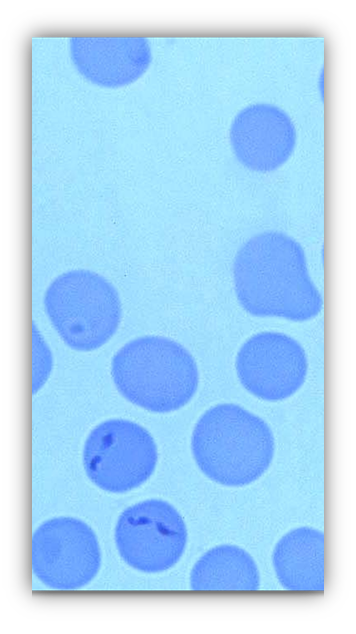 <p>bovine I. host Boophilus annulatus within the RBCs fever icterus anorexia hemoglobinuria diagnose with stained blood smears</p>