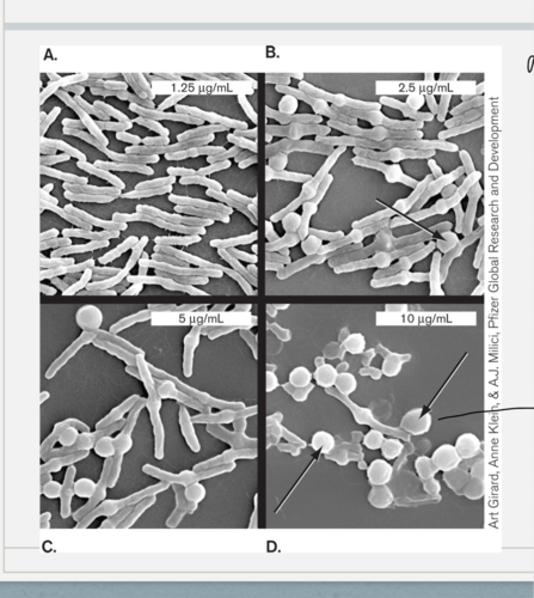 <p>- cells were incubated for one our with the displayed concs of penicillin</p><p>- what happened to the cells is that buldges formed bc the cells are growing, but they cant form cell wall to make those cross links so now osmotic pressure buldged the cells because there is no cell wall to protect them/keep the rigidity and the shape</p><p>- the buldging increases as conc of penicillin increases leading to osmotic lysis</p>