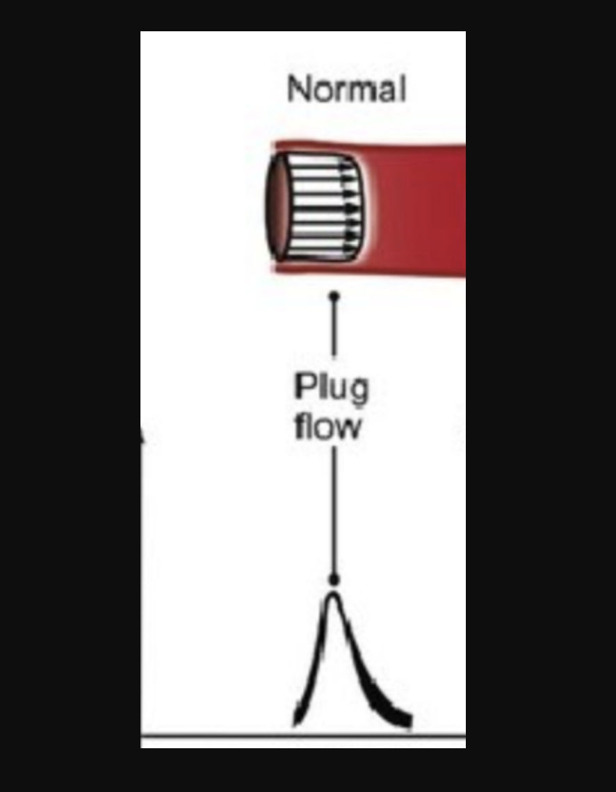 <p>narrow doppler spectrum / Clear frequency window</p>