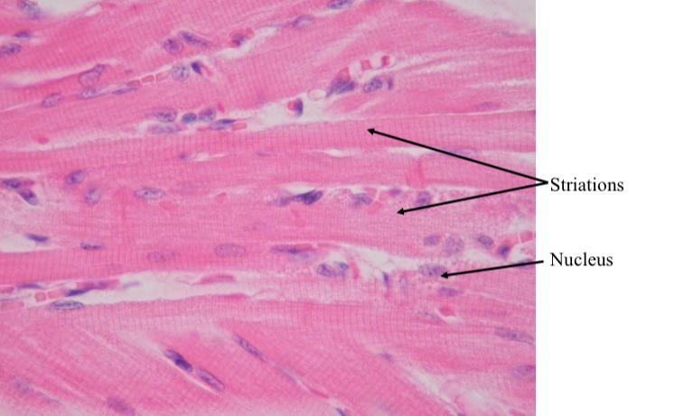 <p>What type of muscle tissue is this?</p>