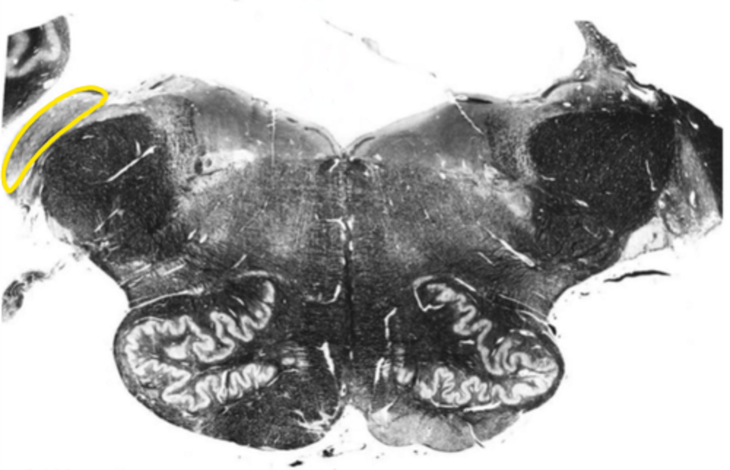 <p>ID the nucleus</p>