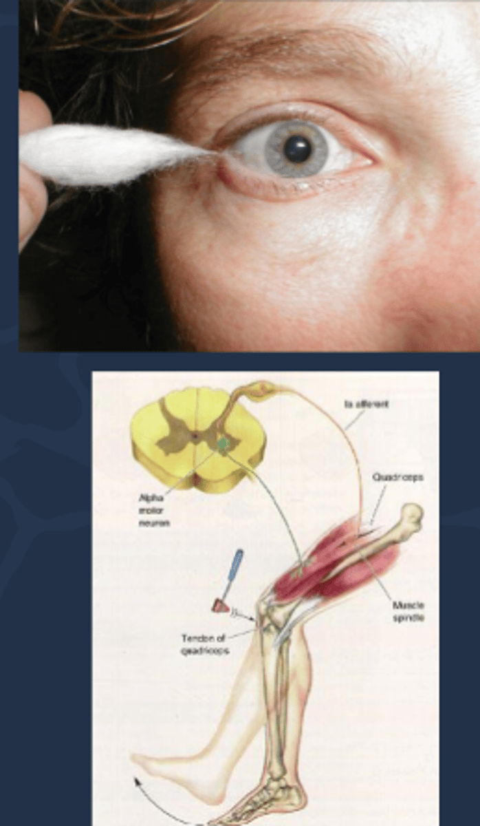 <p>reduced corneal sensitivity bc sensory fibers from CN V1 travel through the damaged ciliary ganglion</p><p>decreased deep tendon reflexes for unknown reasons (called Holmes-Adie syndrome)</p>