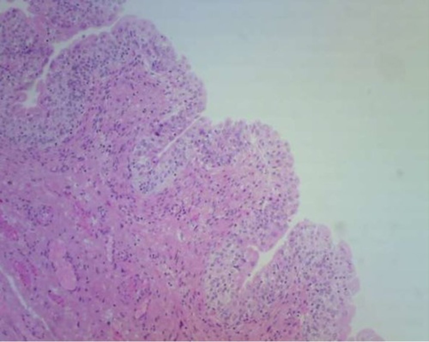 <p>Location: bladder</p><p>Function: stretchability and protection</p>
