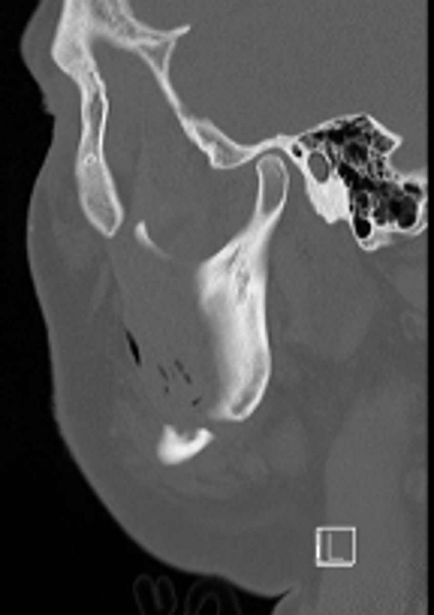 <p>ID the CT view:</p>