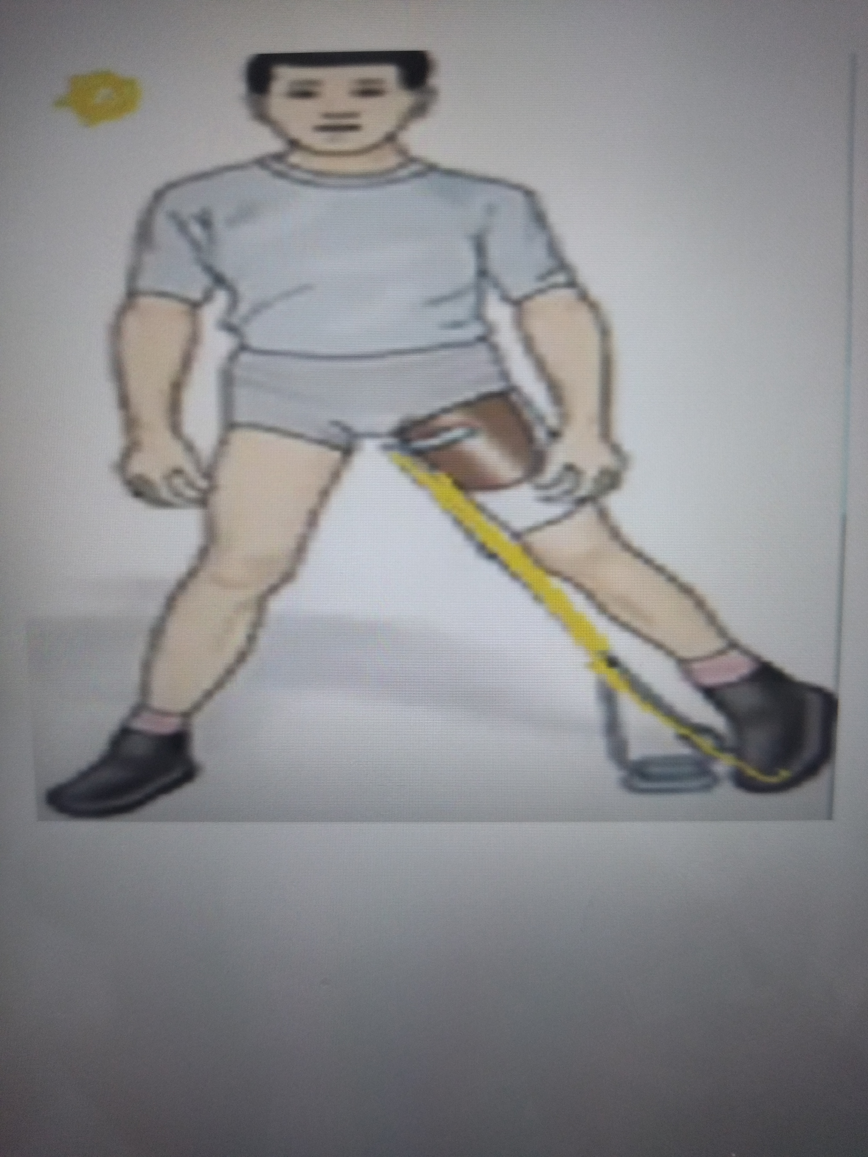 * Unilateral with single medial upright and shoe attachment
* Hold extremity in AbIR