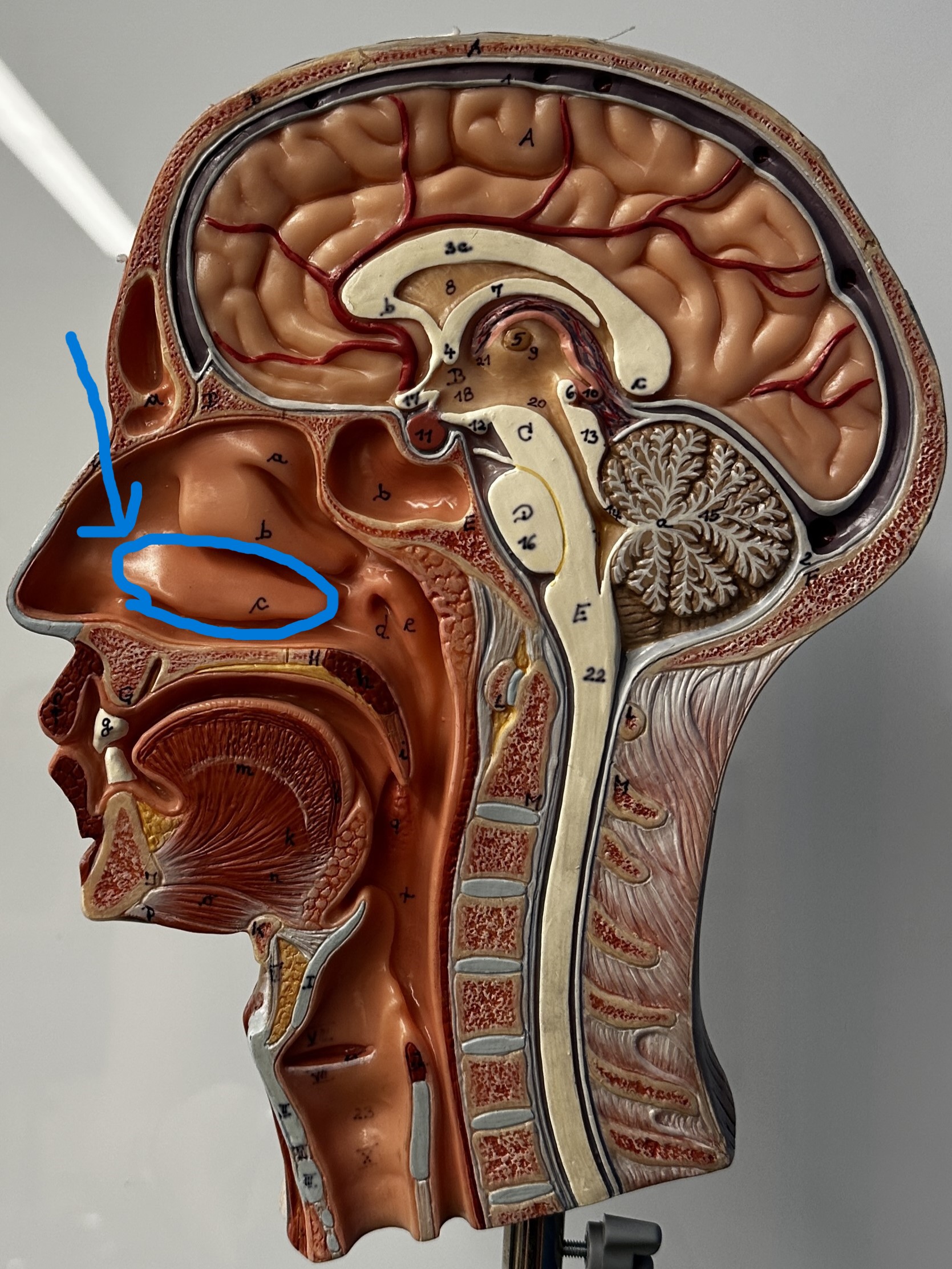 term image