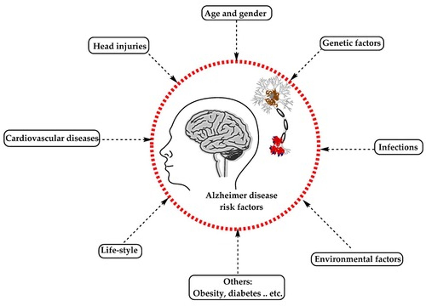 <p>Poor cerebral perfusion, head trauma, female gender, environmental factors, and genetic predispositions.</p>