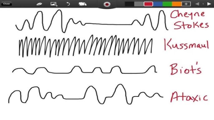 <p>unpredictable irregularity</p>
