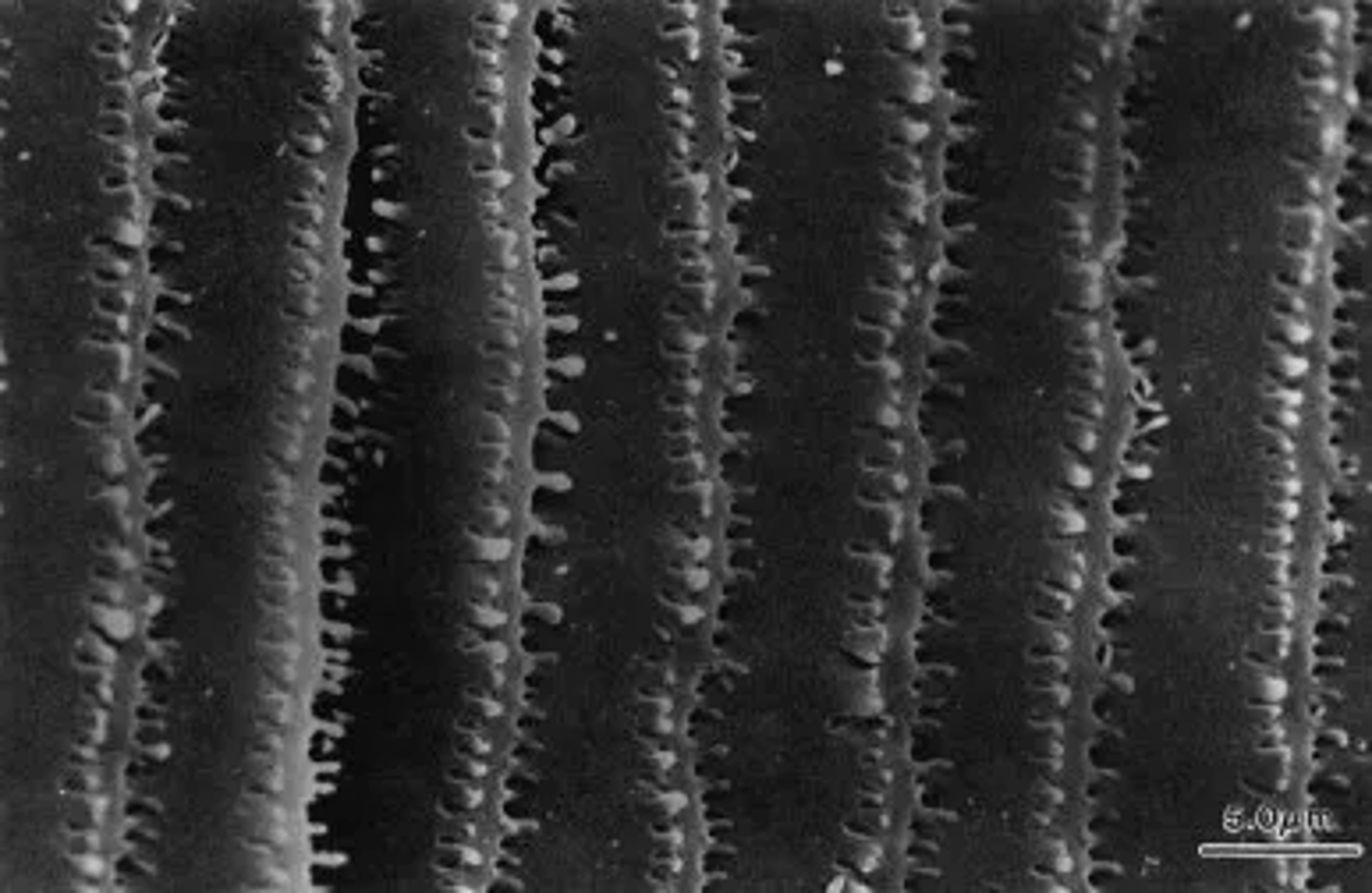<p>Less interstitial fluid between fibers, maintaining clarity and consistent refractive index</p>
