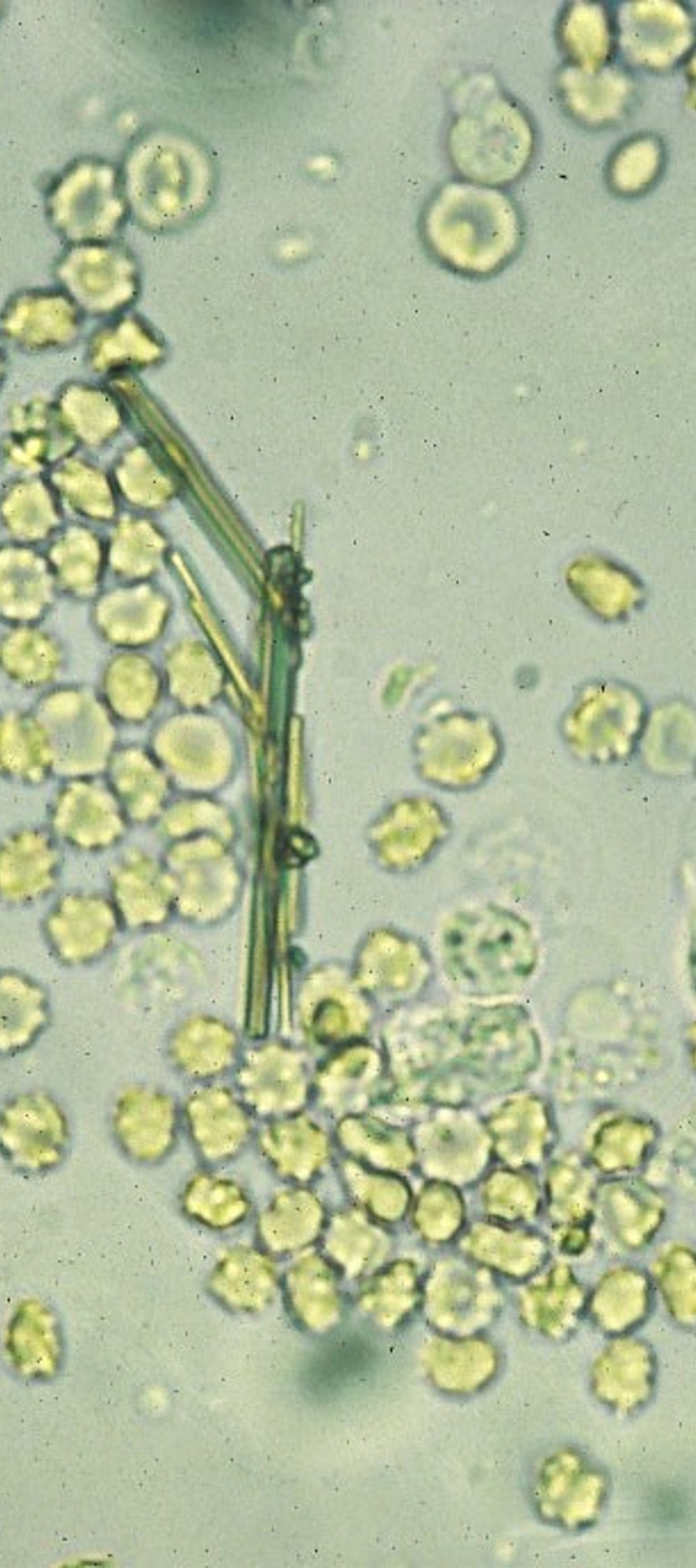 <p>Reported as average/10 HPF</p>