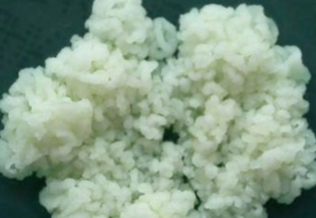 <p>Which sp is this?</p>