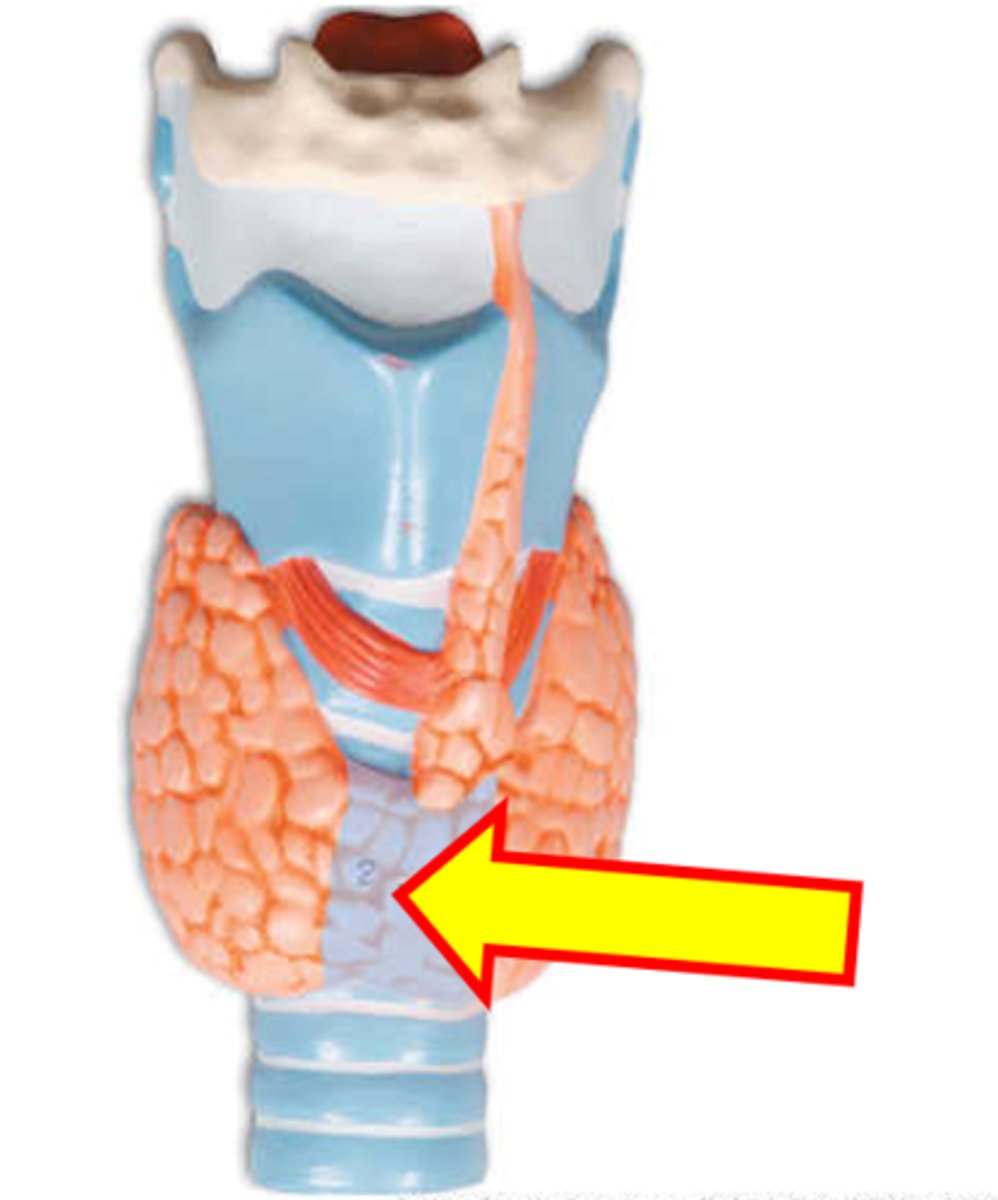 <p>Name just the highlighted area.</p>