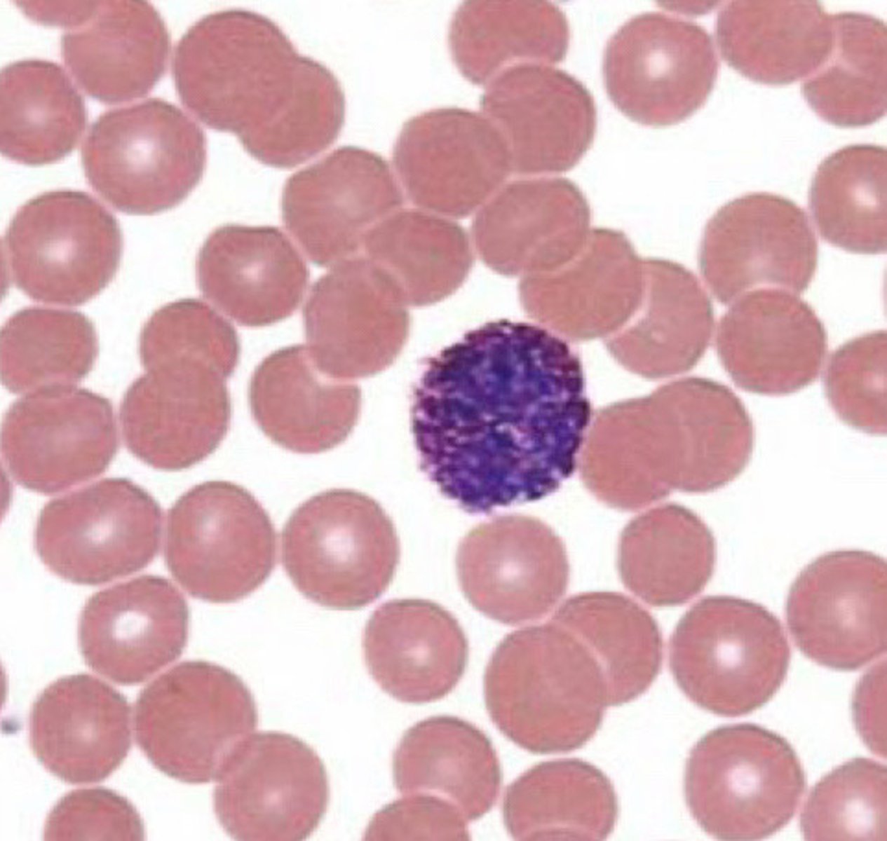 <p>What type of WBC is seen in this image?</p>