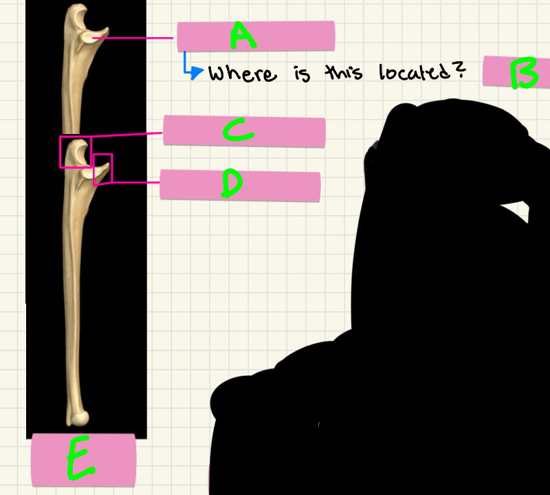 <p>What’s A-E?</p>
