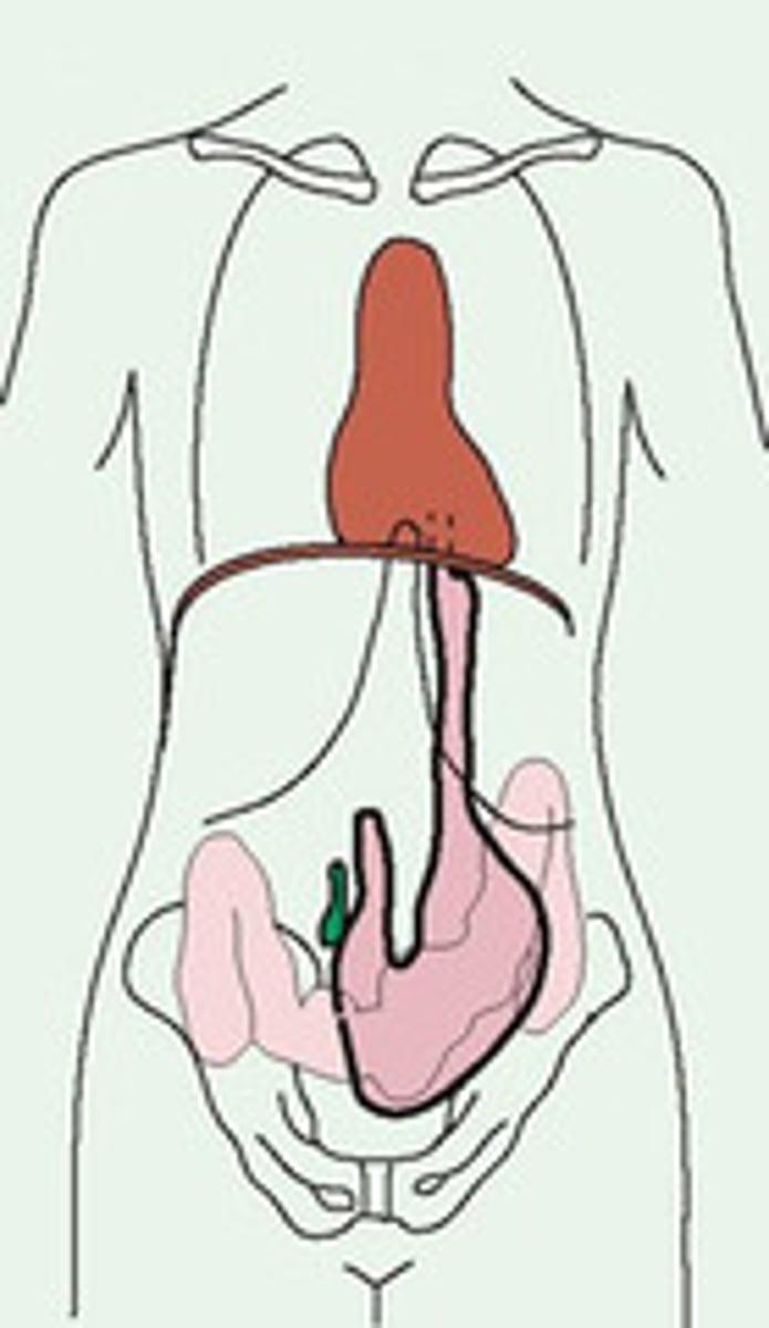 <p>Approximately 10% of the population is very thin or slender with a long and narrow body build.</p>