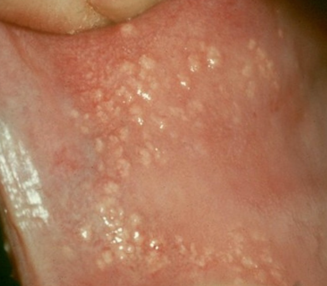 <p>4c. What is the management:</p>