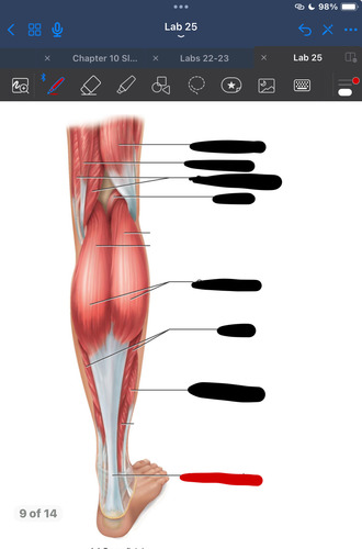<p>What muscle is this?</p>