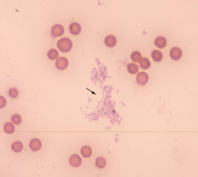 <p>how is&nbsp;<span style="color: rgb(255, 255, 255);"><span>Mycoplasma haemofelis transmitted&nbsp;</span></span></p>