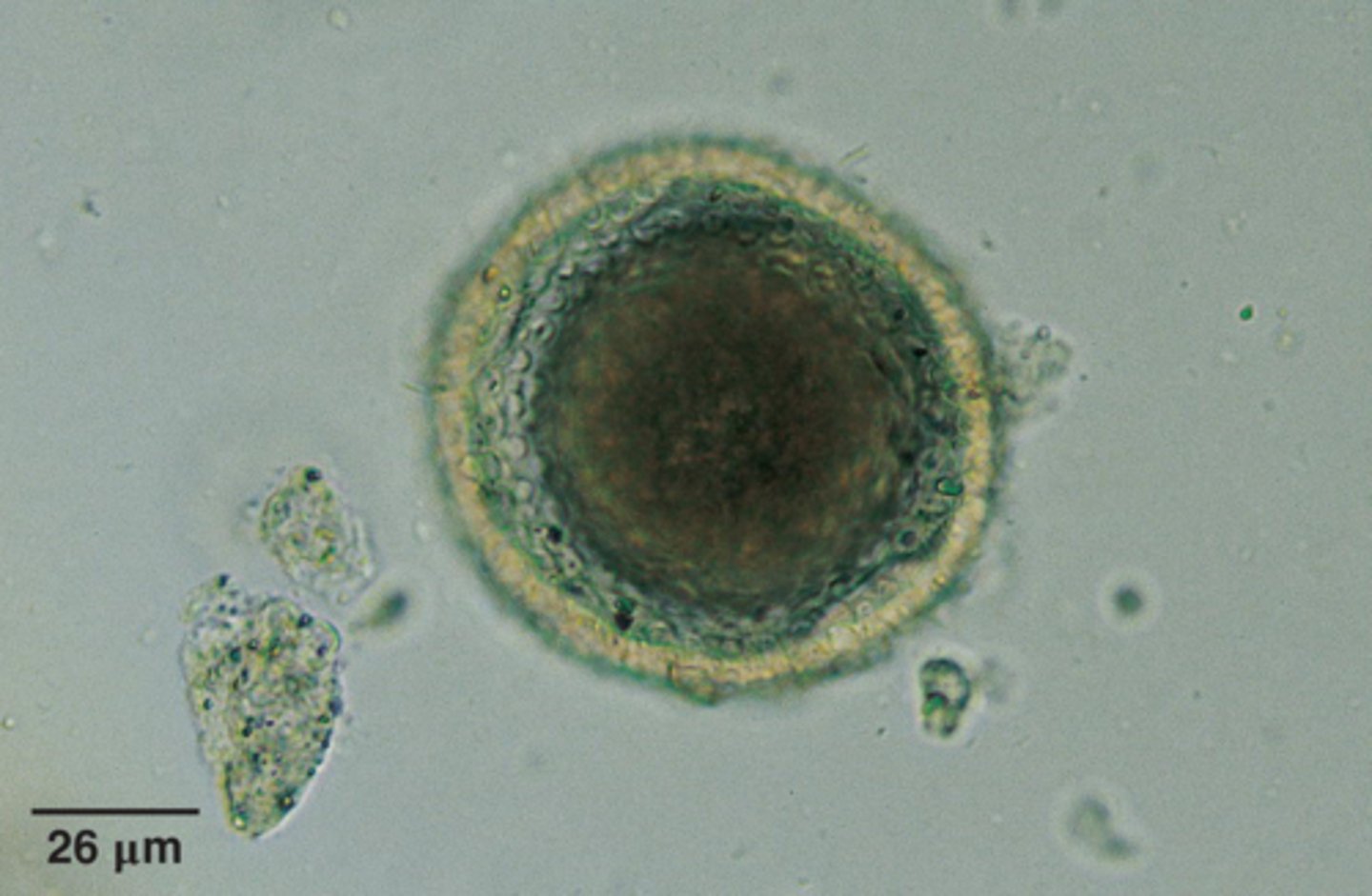 <p>What parasite is this if it is from a dog</p>