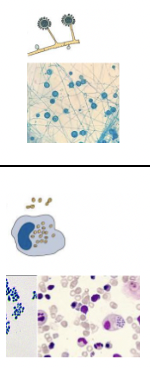 <p>Mould - septate hyphae with small conidia and sunflower macroconidia </p><p>Yeast - small oval budding yeast cells in macrophages </p>