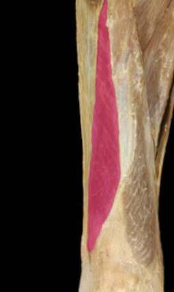 <p>on lateral side of rectus femoris</p>