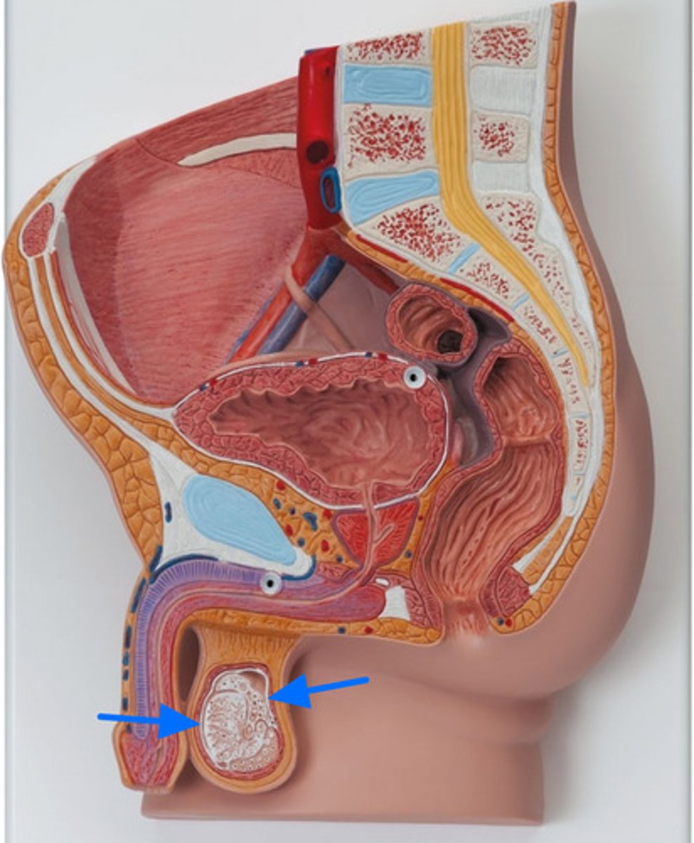<p>ID Structure Marked with the Blue Arrows</p>