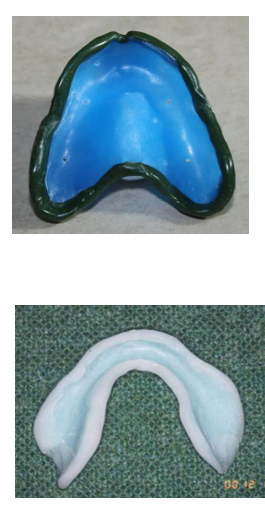 <ul><li><p>green stick</p></li><li><p>self-curing resin</p></li><li><p>silicone putty</p></li><li><p>the final impression spreads over the top of the border moulding</p></li></ul><p></p>