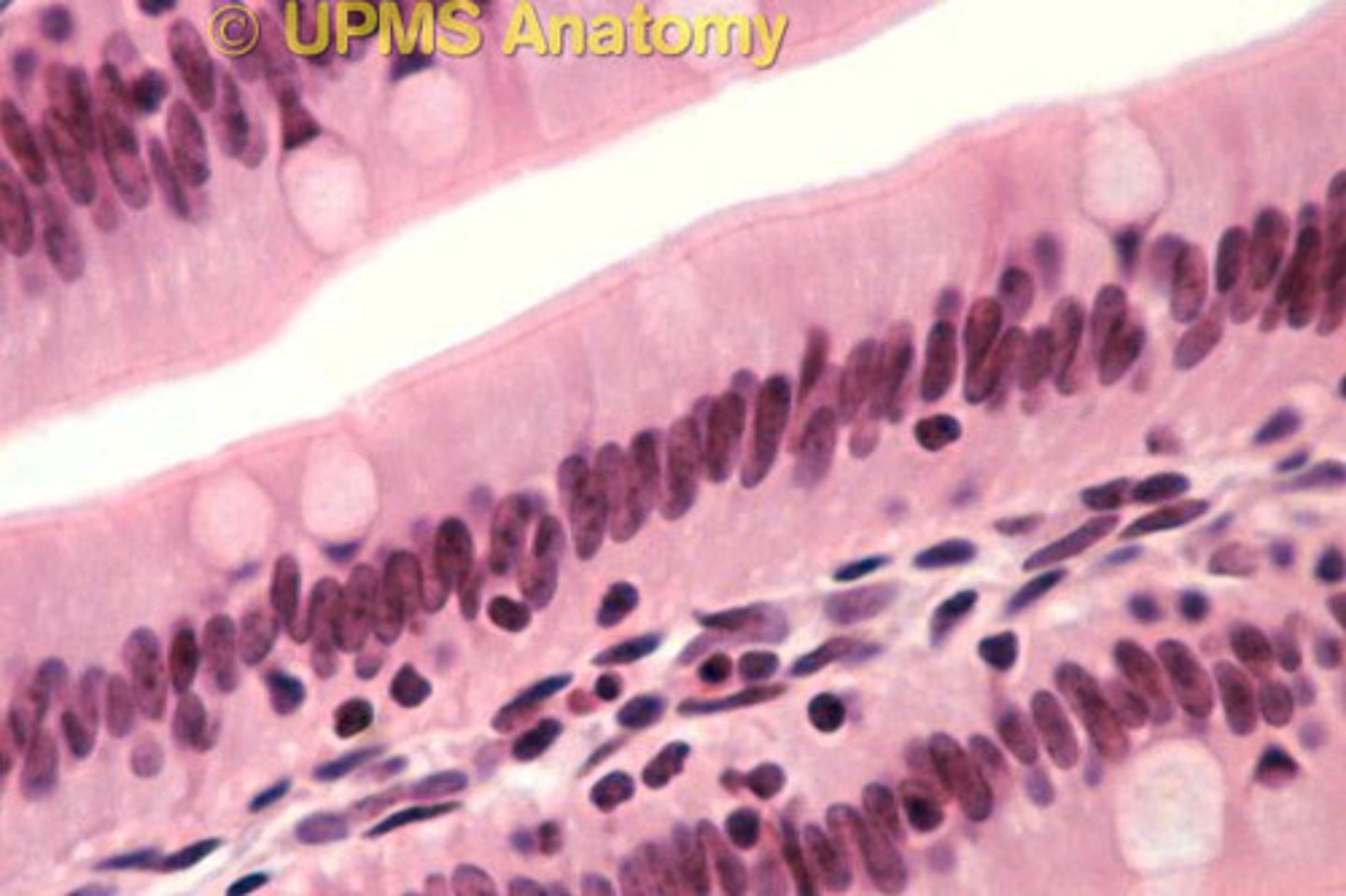 <p>Most deep of the 3 layers of the mucosa.</p>