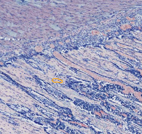 <ol start="4"><li><p>Identify these cells</p></li></ol><p></p>
