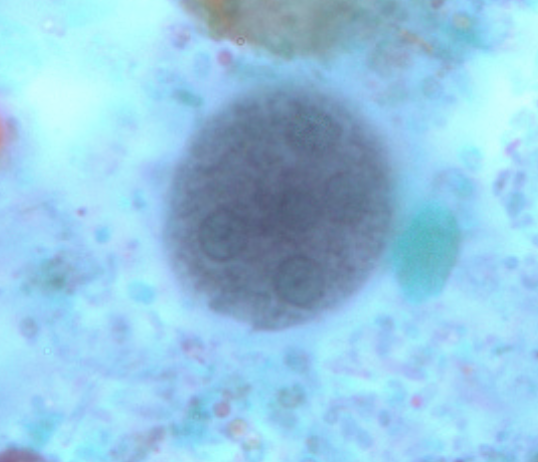 <p>sharp, pointed chromatoid bodies, up to 8 nuclei</p>