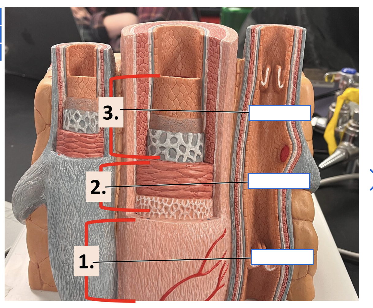 <p>Label this diagram of an artery</p>