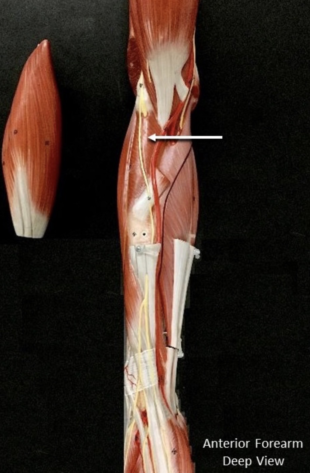 <p><span>Name the muscle labeled with the white arrow below.</span></p>