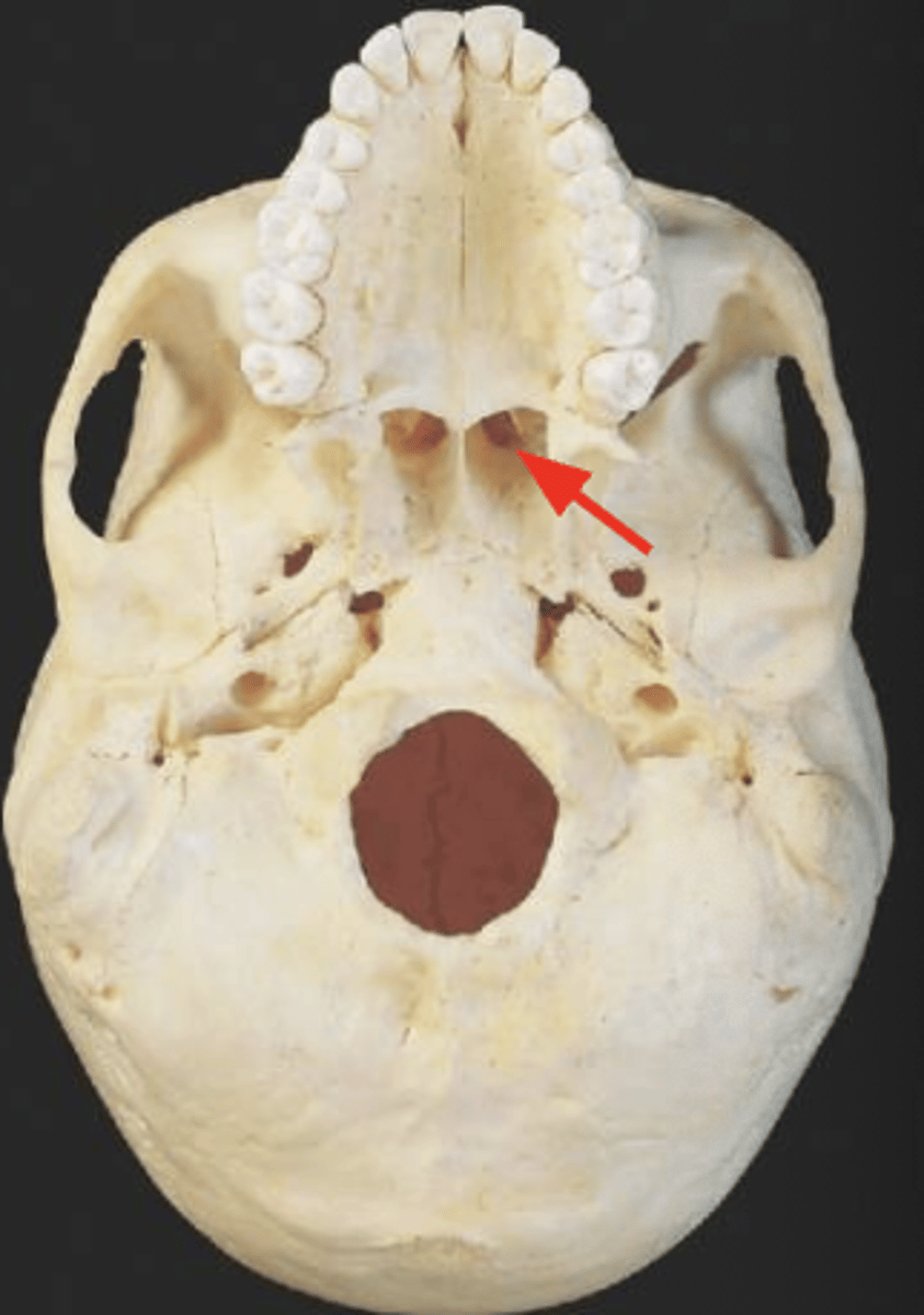 <p>What is the red arrow?</p>