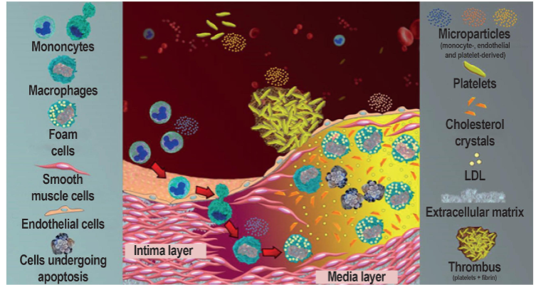 <ul><li><p><span>Cell-derived products which play key role in thrombus formation</span></p></li><li><p><span>Released from cell membrane during apoptosis or activation</span></p></li><li><p><span>Several roles</span></p><ul><li><p><span>Have procoagulant potential</span></p></li><li><p><span>Play role in inflammation, angiogenesis, and immune response</span></p></li><li><p><span>Promote anticoagulant functions and fibrinolytic response</span></p></li></ul></li></ul><ul><li><p><span>Derived from platelets, ECs, RBCs, WBCs, cancer cells</span></p></li><li><p><span>Differ in expression of phosphatidyl serine and/or TF</span></p></li><li><p><span>Controversy--cause of consequence of thrombosis</span></p></li></ul><p></p>
