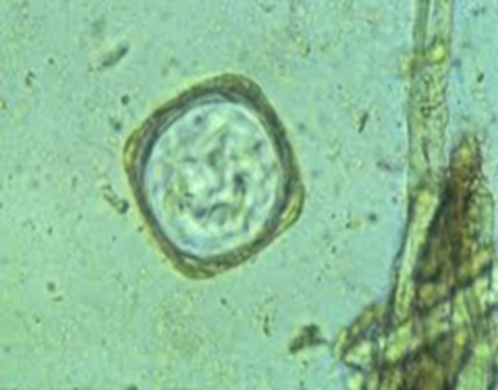 <p>cattle I. host grain mites small intestine square or cuboidal pasture rotation</p>