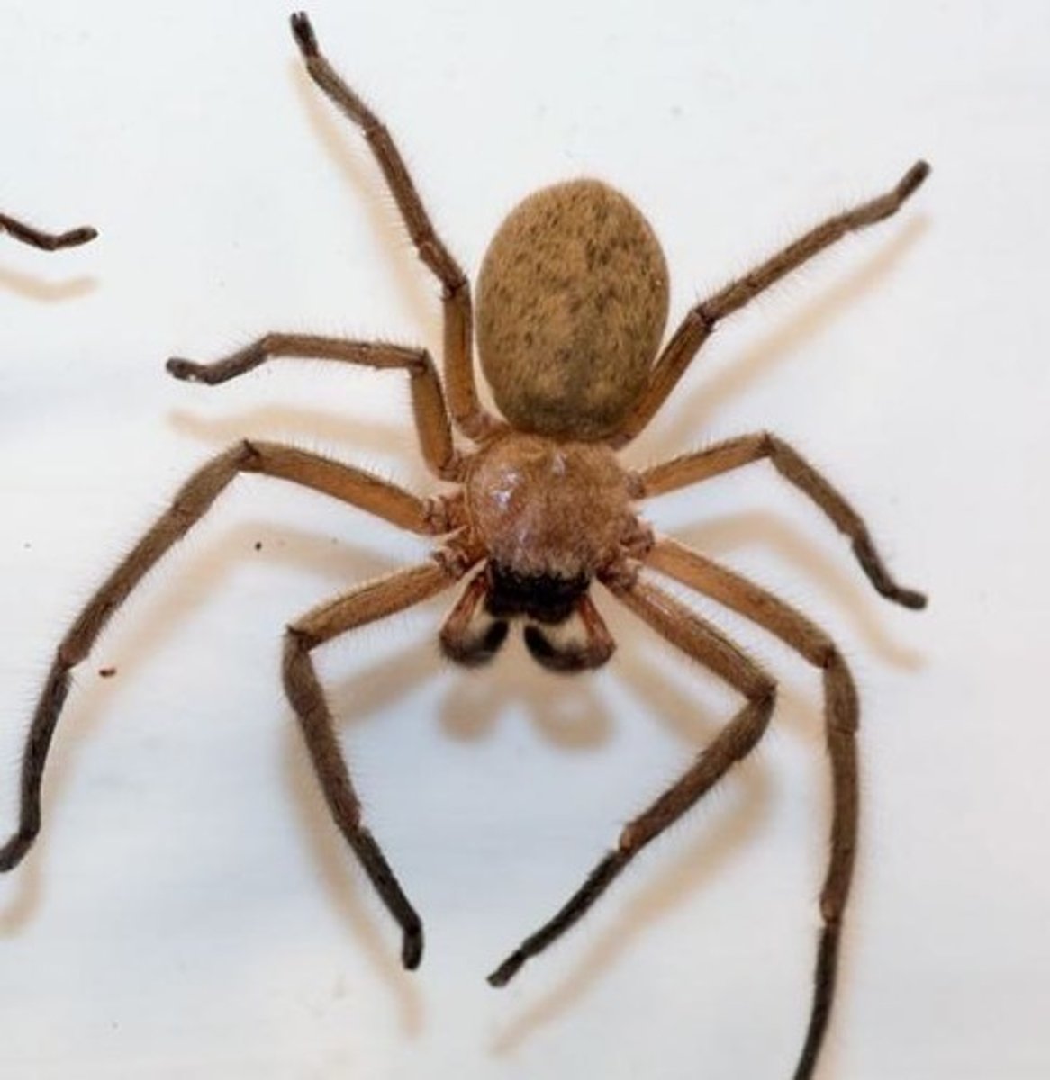 <p>Bizarre, enlarged myocytes with large collections of glycogen, known as 'spider cells'.</p>