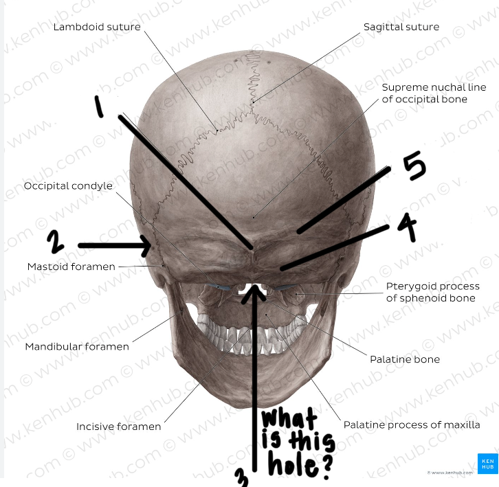 <p>Label the posterior skull</p>