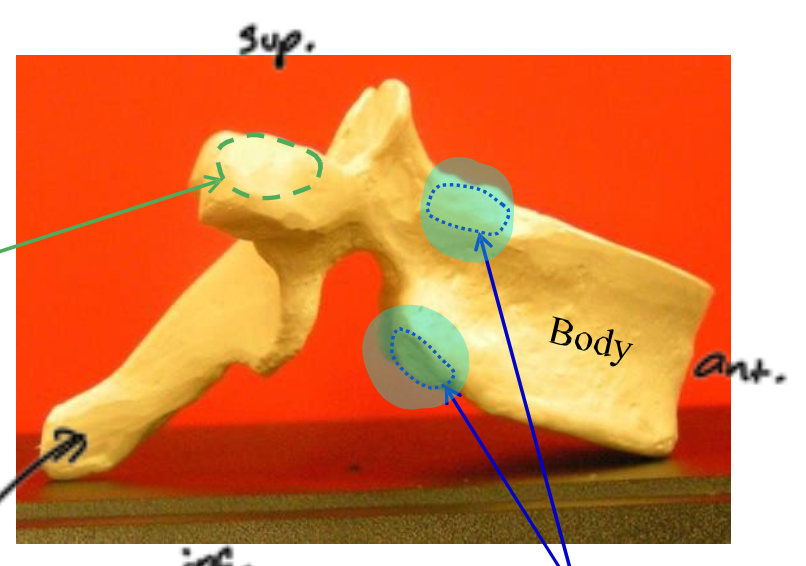 <p>Name the highlighted structure</p>