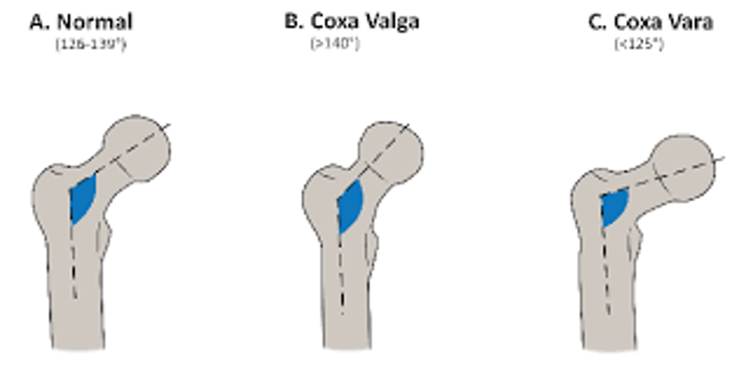 <p>coxa valga</p><p>3 multiple choice options</p>