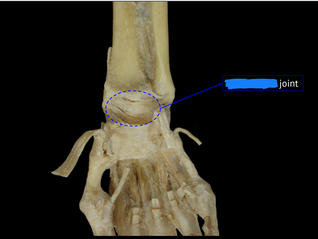 <p>name the joint</p>