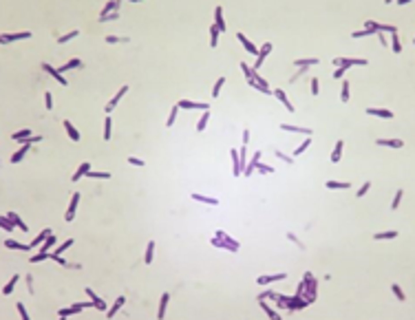 <p>· Reservoir: soil, dust, manures; vaccine-preventable illness</p><p>· Infections: tetanus (rigid paralysis); potential mortality due to asphyxiation</p>