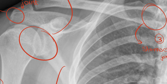 <p>Identify 4 joints ? What view? WHAT IS THAT ?</p>