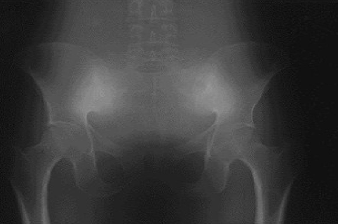 <p><span style="color: rgb(255, 255, 255);"><span>fog which decreases the contrast in the radiograph</span></span></p>