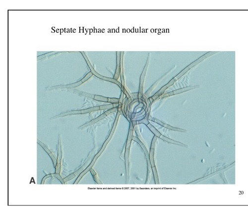 <p>what type of hyphae is this</p>