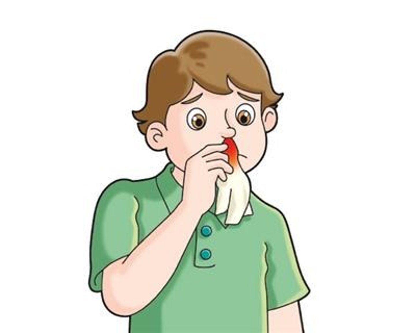 <p>nosebleed, epistaxis</p>