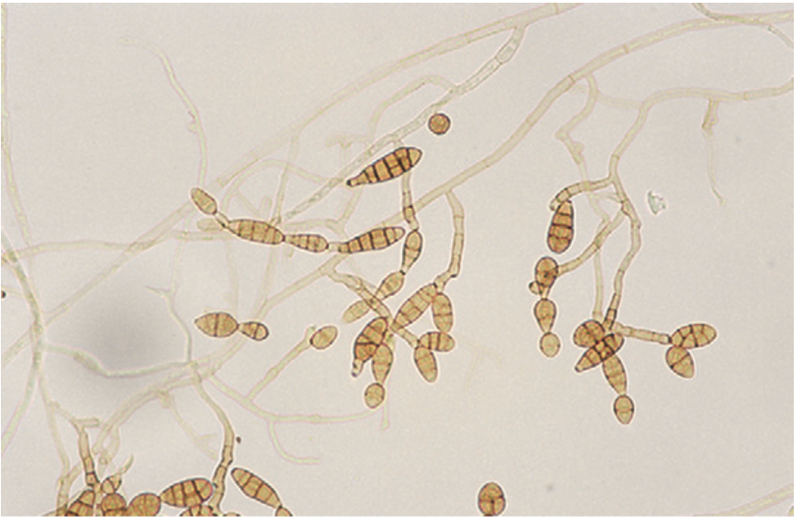 <p>A genus of fungi including various allergenic and pathogenic species.</p>