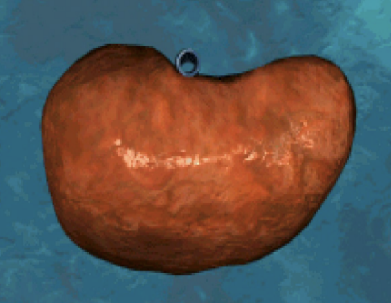 <p>Which surface of the liver is this? And describe it.</p>